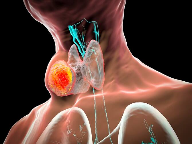 Top Signs Of Throat Cancer You Should Never Overlook | Throat Cancer: धीरे-धीरे गले में कैंसर फैलने पर शरीर देता है ये संकेत, इन लक्षण को कभी भी नज़रअंदाज़ नहीं करना चाहिए Top Signs Of Throat Cancer You Should Never Overlook | Throat Cancer: धीरे-धीरे गले में कैंसर फैलने पर शरीर देता है ये संकेत, इन लक्षण को कभी भी नज़रअंदाज़ नहीं करना चाहिए
