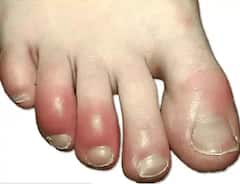 ਜੇਕਰ ਤੁਹਾਡੇ ਸਰੀਰ 'ਚ ਨਜ਼ਰ ਆਉਂਦੇ ਹਨ ਇਹ ਬਦਲਾਅ, ਤਾਂ ਤੁਹਾਨੂੰ ਹੋ ਸਕਦਾ ਕੈਂਸਰ ਦਾ ਖਤਰਾ