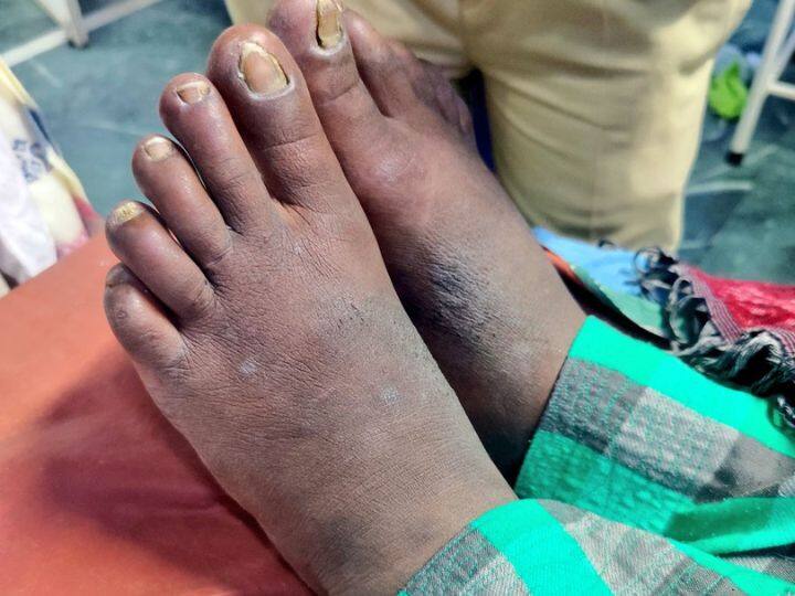 gurugram minor maid beaten with hot tongs by gurugram couple ate food from dustbin Minor Maid Beaten: गर्म चिमटे से पीटा, डस्टबिन से खाना खाने को किया मजबूर, 14 साल की मेड पर इस तरह ढाए जुल्म