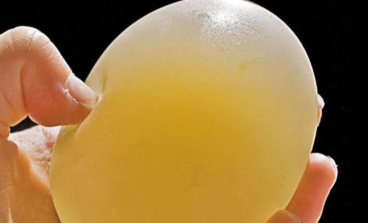 এখনও পর্যন্ত উদ্ধার জীবাশ্ম থেকে জুরাসিক যুগের আগে ‘ট্রু বার্ড’ (এখনকার পাখির আদি বংশ)-এর অস্তিত্বের প্রমাণ মেলেনি, যারা কিনা আধা জলজ ছিল। তবে খোসা সুদ্ধ ডিমের আবির্ভাব তার আগেই বলে মত বিজ্ঞানীদের, আনুমানিক ৩৩ কোটি বছর আগে। সেই নিরিখে মুরগির আগে ডিমের আবির্ভাব ঘটে। তবে সেই সময় বাইরে শক্ত খোসার আবরণ নয়, ডিমের গঠন নরম রবারের বলের মতো ছিল হয়ত, বর্তমানে সরীসৃপের ডিম যেমন হয়।