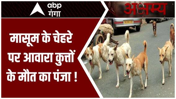 Moradabad में आवारा कुत्तों के हमले से घायल बच्ची की हालत गंभीर ! | UP News | Abp Ganga Akshamya
