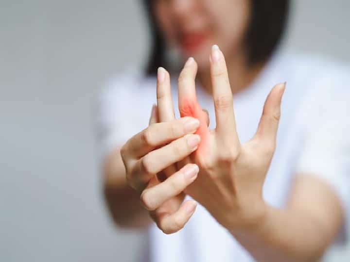 Osteoarthritis The sign that appears in your hand Osteoarthritis: जोड़ों की अकड़न हो सकती है इस गंभीर के संकेत, आपके हाथ में इस तरह देता है दिखाई