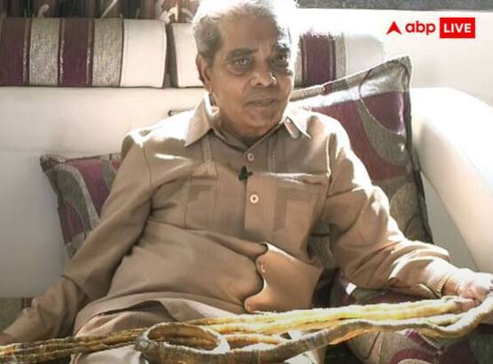 ਸ਼੍ਰੀਧਰ ਚਿੱਲਾਲ ਨੇ ਆਪਣੇ ਨਹੁੰ ਕਿਉਂ ਵਧਾਏ? ਇਸ ਸਵਾਲ ਦਾ ਜਵਾਬ ਦਿੰਦਿਆਂ ਉਨ੍ਹਾਂ ਨੇ ਦੱਸਿਆ ਕਿ ਜਦੋਂ ਉਹ 14 ਸਾਲ ਦੇ ਸਨ ਤਾਂ ਸਕੂਲ ਵਿਚ ਉਨ੍ਹਾਂ ਦੀ ਸ਼ਰਾਰਤ ਕਾਰਨ ਉਨ੍ਹਾਂ ਦੀ ਟੀਚਰ ਦੇ ਲੰਬੇ ਨਹੁੰ ਟੁੱਟ ਗਏ ਸਨ, ਜਿਸ ਕਾਰਨ ਉਹ ਬਹੁਤ ਗੁੱਸੇ ਵਿਚ ਸੀ ਅਤੇ ਉਦੋਂ ਤੋਂ ਹੀ ਉਨ੍ਹਾਂ ਨੇ ਮਨ ਵਿਚ ਫੈਸਲਾ ਕੀਤਾ ਕਿ ਉਹ ਆਪਣੇ ਨਹੁੰ ਲੰਬੇ ਆਪਣੇ ਟੀਚਰ ਨਾਲੋਂ ਲੰਗੇ ਕਰਕੇ ਦਿਖਾਉਣਗੇ।