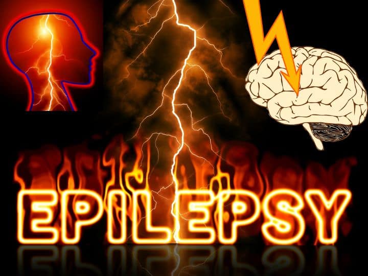 international epilepsy day what is the cause and treatment for epilepsy how does it affects mental health International Epilepsy Day: हर 1 हजार में 14 को है मिर्गी की बीमारी...मानसिक कमजोरी नहीं, ये है इसका सबसे आम कारण