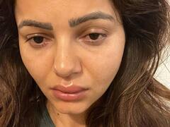 रुबीना दिलैक के चेहरे का हुआ बुरा हाल, फोटोज देखकर नहीं पहचान पाएंगे आप