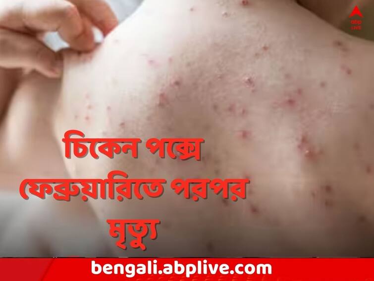 Kolkata News Multiple Death due to Chicken Pox in West Bengal WB Chicken Pox: চিকেন পক্সে রাজ্যে পরপর মৃত্যু, ফেব্রুয়ারিতে না ফেরার দেশে কজন ?