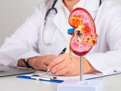 क्या दोनों किडनी डैमेज होने के बावजूद व्यक्ति जिंदा रह सकता है? यहां जानिए इस सवाल का सही जवाब