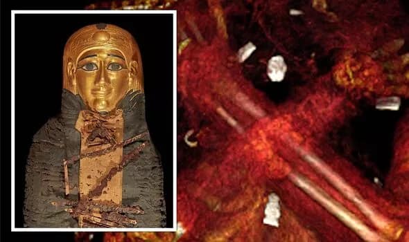 Golden boy mummy was protected by 49 precious amulets CT scans reveal gold heart gold tongue found in 2300 years old cairo mummy Golden Boy Mummy : सोन्याचं हृदय, सोन्याची जीभ; 2300 वर्ष जुन्या ममीमध्ये सापडला खजिना, शास्त्रज्ञही अवाक्