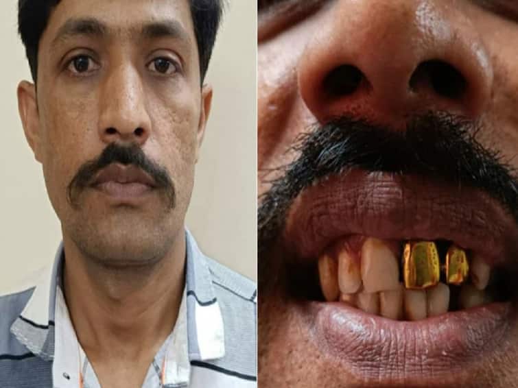 Mumbai Two Gold Teeth Help police Arrest Fugitive Missing For 15 Years know more details இரட்டை தங்க பற்கள்.. 15 ஆண்டுகளுக்கு பிறகு கடத்தல்காரரை பொறி வைத்து பிடித்த மும்பை போலீஸ்..நடத்தது என்ன?