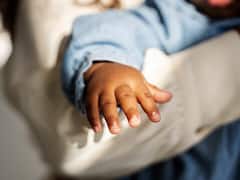 क्या है कार्बन बेबी सिंड्रोम जिसमें बच्चे की त्वचा पड़ जाती है काली...जानिए क्या है इसका इलाज