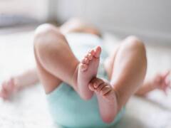 முட்டாள்தனத்தின் உச்சம்...இருமலில் தவித்த 2 மாத குழந்தை...சிகிச்சை அளிப்பதாகக் கூறி சூடு போட்ட போலி மருத்துவர்..!