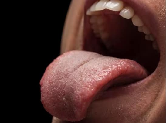 dry-mouth-called-xerostomia-causes-symptoms-treatment ਜੇਕਰ ਤੁਹਾਡਾ ਮੂੰਹ ਵੀ ਸੁੱਕਿਆ ਰਹਿੰਦਾ ਹੈ? ਸਲਾਈਵਾ ਨਹੀਂ ਬਣਦਾ, ਤਾਂ ਤੁਸੀਂ ਇਸ ਬਿਮਾਰੀ ਦੇ ਹੋ ਸਕਦੇ ਸ਼ਿਕਾਰ