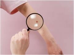 ఒక క్యాన్సర్ కణితే ఎంతో బాధిస్తుంది, పాపం ఈమెకు శరీరంలో 20 క్యాన్సర్ కణితులు