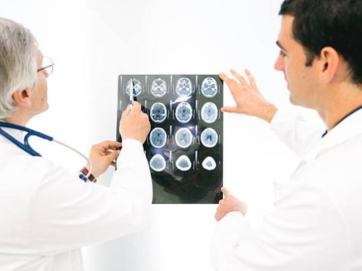 ब्रेन स्ट्रोक और ब्रेन हैमरेज में क्या है अंतर? शरीर में हो रही हैं ये दिक्कतें तो मतलब आ सकता है अटैक Brain haemorrhage is a type of stroke that is caused when an artery in the brain bursts ब्रेन स्ट्रोक और ब्रेन हैमरेज में क्या है अंतर? शरीर में हो रही हैं ये दिक्कतें तो मतलब आ सकता है अटैक