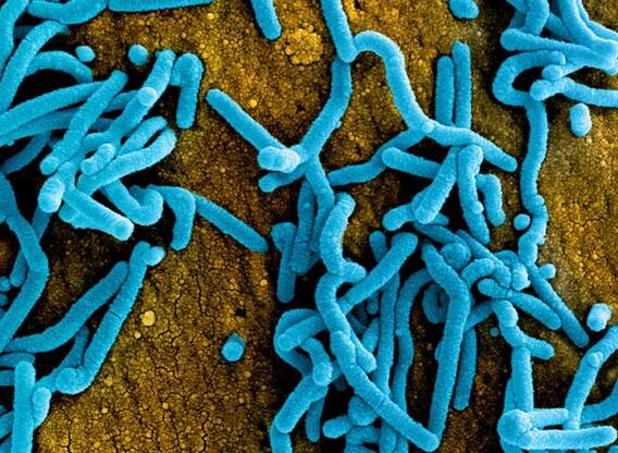 Marburg Virus : कोरोनापेक्षाही धोकादायक 'मारबर्ग' विषाणू