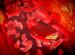 रोज सुबह नाश्ते  में एक कटोरी खाएं दलिया...इन 7 समस्याओं को दूर भगाएं