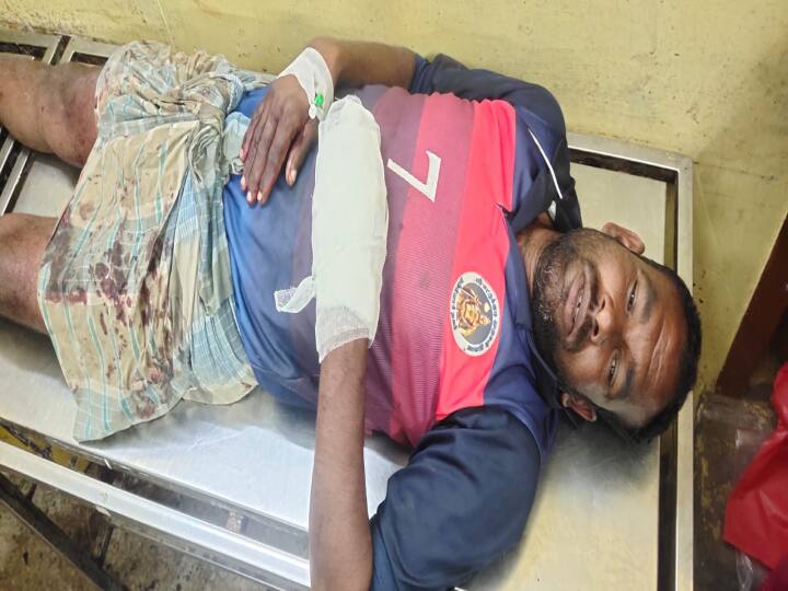 Srilankan Sea pirates attacked Nagapattinam Fishermen TNN மீனவரின் விரல்களை துண்டாடிய கொடூரம்.... நடுக்கடலில் இலங்கை கொள்ளையர்கள் அட்டூழியம்... கதறிய பெண்கள்..!
