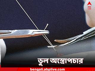Viral News: হাইড্রোসিলের চিকিৎসায় 'বন্ধ্যাত্বকরণ'! স্বাস্থ্যকেন্দ্রে ভুল অস্ত্রোপচার