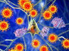 इस सुपरस्टार को हुई गंभीर बीमारी जिसका पूरी दुनिया में इलाज नहीं, जानें इसके लक्षण