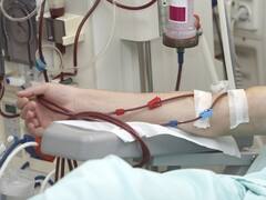 सफदरजंग हॉस्पिटल में हेमोडायलिसिस यूनिट की शुरुआत, अब रात 8 बजे तक करा सकेंगे डायलिसिस