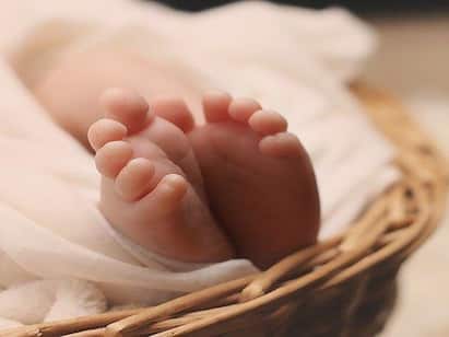Brazil baby girl born with 6 cm tail  from her backbone doctors shocking Baby With Tail : விசித்திரம்.. 6 செ.மீ வாலுடன் பிறந்த குழந்தை... அரிய நிகழ்வு என மருத்துவர்கள் வியப்பு...!