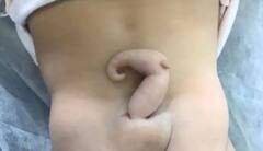 Shocking News: 6 ਸੈਂਟੀਮੀਟਰ ਦੀ ਪੂਛ ਨਾਲ ਪੈਦਾ ਹੋਈ ਬੱਚੀ, ਦੇਖ ਕੇ ਡਾਕਟਰ ਵੀ ਰਹਿ ਗਏ ਹੈਰਾਨ