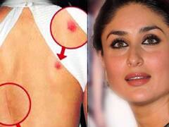 इन एक्ट्रेसेस के छुपाए नहीं छुपे लव बाइट्स, तस्वीरें वायरल होते ही मच गया था इंटरनेट पर तहलका