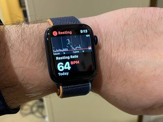 Apple Tech : Future Apple Watch may be Able to Monitor Blood Glucose Sugar Without Pricking the Skin and Blood Apple Tech : ના લોહી નિકળશે કે ના દુ:ખાવો થાય... આ રીતે સુગર ટેસ્ટ કરશે Apple Watch