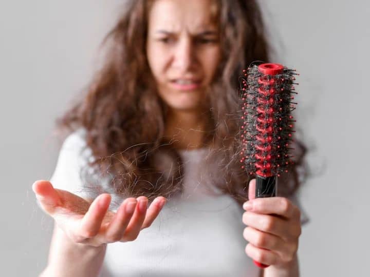 Hair Loss Problems Use These 5 Home Remedies For Hair Fall बालों का झड़ना रोक सकती हैं ये 5 करिश्माई चीज़ें, इनका ऐसे करें इस्तेमाल, दिखेंगे फायदे