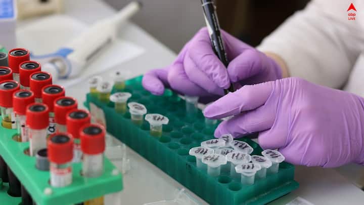 এই রোগে শুধু ওষুধ খেলেই হয় না, যথেষ্ট পুষ্টিকর খাবার খেতে হয়। এবার সঙ্গে যদি ইউরিক অ্যাসিড থাকে, তাহলে জোড়া বিপত্তি।