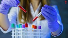 Avoid Thyroid: থাইরয়েডে কী মেনে চলা উচিত ? কোন খাবারটা একদমই নয় ?