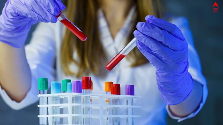 থাইরয়েডের সমস্যা থাকলে , প্রথমে অনেকেই এটি গুরুত্ব দেন না। কিন্তু এটা বেড়ে গেলে ভয়াবহ আকার ধারণ করে।