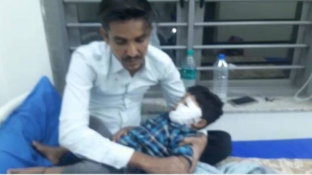 A 2-year-old child was attacked by a dog in Eder, and suffered major injuries on his face Dog Terror: 2 વર્ષના બાળક પર તૂટી પડ્યું કૂતરૂં, ચહેરા પર એક નહિ બે નહિ આવ્યાં 80 ટાંકા