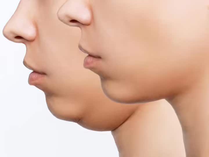 practice these four face exercise for double chin डबल चिन की वजह से हैं परेशान? इन 4 एक्सरसाइज को रोजाना करके देखिए, हफ्ते भर में दिखेगा रिजल्ट
