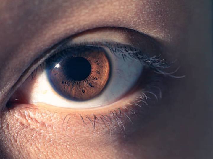 Early Signs of Heart Disease Appear in the Eyes आने वाला है हार्ट अटैक, आंखों में दिख जाते हैं संकेत...समय रहते ही करवा लें इलाज