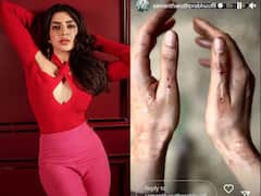 Samantha Ruth Prabhu Injured While Shooting For Indian Adaptation Of 'Citadel'