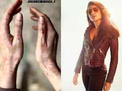 షాకింగ్, షూటింగ్‌లో సమంతకు గాయాలు - రక్తం కారుతున్న చేతులతో ఇన్‌స్టా పోస్ట్