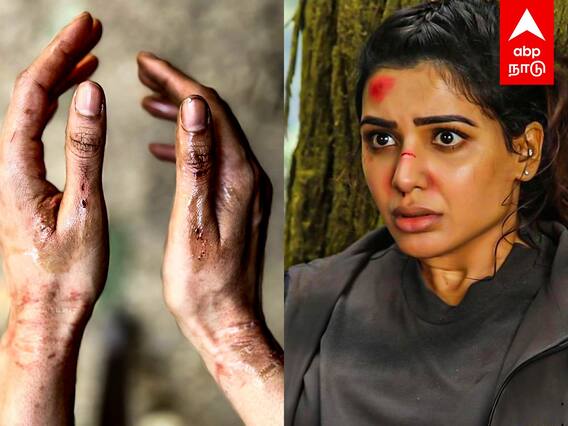 Samantha Accident : Shooting Spot-இல் அடுத்த அடி..மீண்டும் காயமடைந்த சமந்தா! அதிர்ச்சியில் ரசிகர்கள்