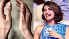 অ্য়াকশন দৃশ্য়ের শ্য়ুটিং-এ গুরুতর আহত সামান্থা, এখন কেমন আছেন?