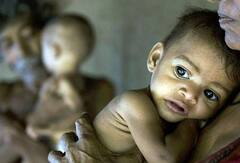 Gandhinagar: ગુજરાતના આ જિલ્લામાં છે 18 હજારથી વધુ કુપોષિત બાળકો જાણો અમદાવાદની શું છે સ્થિતિ