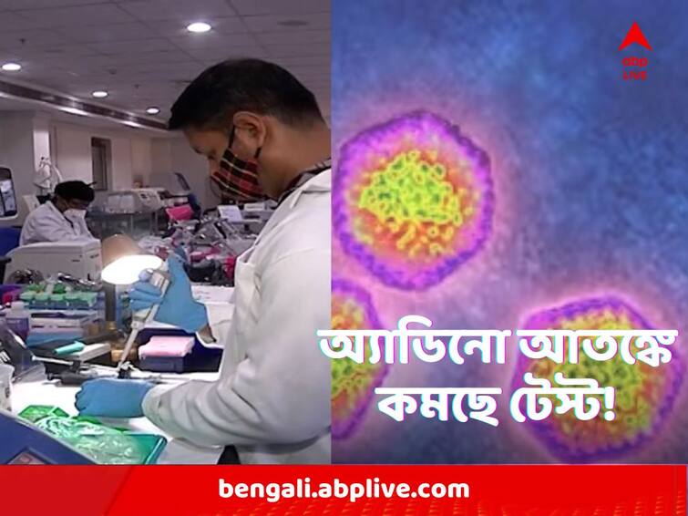 Adenovirus Test : অ্যাডিনো আতঙ্কের মাঝে কিটের আকাল, একাধিক হাসপাতালে বন্ধ পরীক্ষাই ! 'মূল্যবান' বেসরকারিতে নাজেহাল Adenovirus Test Expensive kit creating a barrier in tracing down off in several hospitals Adenovirus Test : অ্যাডিনো আতঙ্কের মাঝে কিটের আকাল, একাধিক হাসপাতালে বন্ধ পরীক্ষাই ! 'মূল্যবান' বেসরকারিতে নাজেহাল