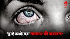 চোখ কটকট, কারণে-অকারণে জল পড়ে? 'ড্রাই আইস' নয় তো?