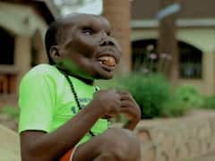 Ugliest People: ये हैं दुनिया के 6 सबसे बदसूरत इंसान, इनके नाम दर्ज है वर्ल्ड रिकॉर्ड