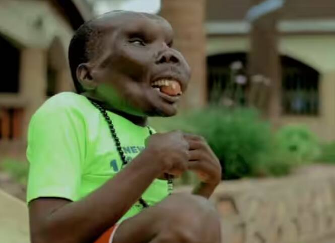 ਗੌਡਫਰੇ ਬਗੁਮਾ ਯੂਗਾਂਡਾ ਦਾ ਇੱਕ 47 ਸਾਲਾ ਵਿਅਕਤੀ ਹੈ ਜੋ ਆਪਣੇ ਚਿਹਰੇ ਦੇ ਇੱਕ ਪਾਸੇ ਵਿਕਰਤੀ ਨਾਲ ਪੈਦਾ ਹੋਇਆ ਸੀ। ਇਸ ਦੇ ਬਾਵਜੂਦ ਉਹ ਬਹੁਤ ਹੀ ਪ੍ਰਤਿਭਾਸ਼ਾਲੀ ਅਤੇ ਸਧਾਰਨ ਵਿਅਕਤੀ ਮੰਨਿਆ ਜਾਂਦਾ ਹੈ। ਉਸ ਦਾ ਵਿਆਹ ਕੇਟ ਨਾਂ ਦੀ ਔਰਤ ਨਾਲ ਹੋਇਆ ਹੈ, ਜਿਸ ਨੂੰ ਉਹ ਬਹੁਤ ਪਿਆਰ ਕਰਦਾ ਹੈ।