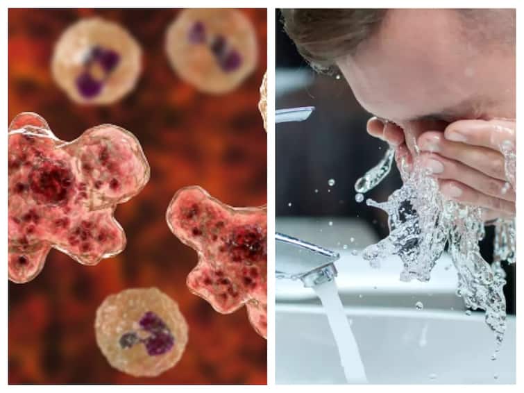 Amoeba America brain eating amoeba his dead here is why Amoeba : முகம் கழுவும்போது மூக்கினுள் தண்ணீர் போகாம பார்த்துகோங்க; மனித மூளையை உண்ணும் அமீபா... துடிதுடித்து இறந்த இளைஞர்!