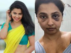 Anicka Vikhraman: உடல் முழுக்க காயம்.. காதலனால் தாக்கப்பட்ட பிரபல நடிகை.. அதிர்ச்சியளிக்கும் புகைப்படங்கள்