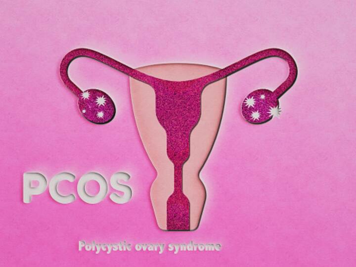 Womens Day 2023 What Is The Difference Between PCOS And PCOD Experts Suggest Foods To Prevent Them Women’s Day 2023: What Is The Difference Between PCOS And PCOD? Experts Suggest Foods To Prevent Them