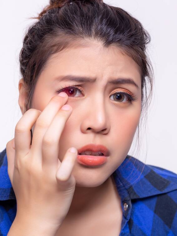 रंगों से हुआ आई इनफेक्शन? चुटकियों में पाएं राहत