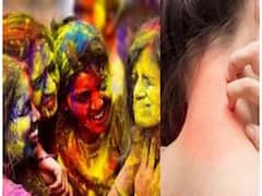 Health: હોળી રમ્યા પછી થયું છે સ્કિન ઈન્ફેક્શન, તો કરો આ ઉપાય