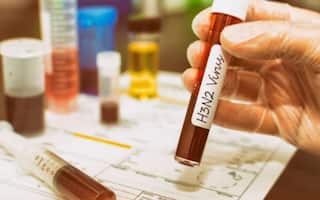 H3N2: One more suspected patient admitted to Sayaji Hospital in Vadodara city H3N2: વડોદરા શહેરમાં વધુ એક શંકાસ્પદ દર્દી સયાજી હોસ્પિટલમાં દાખલ